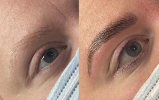 Brow Lamination