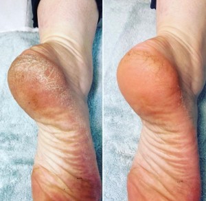 Elim pedicure kg salon