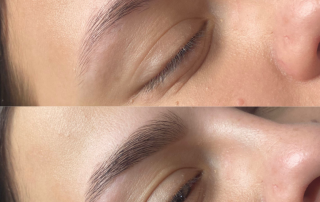 Before and after KG Brows